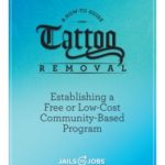 Tattoo artists can increase their business by offering tattoo removal services